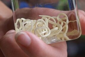 الطفيليات من جسم الإنسان