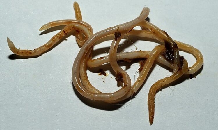 التوكسوكارا من جسم الإنسان